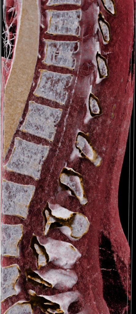 imagerie cardio-vasculaire