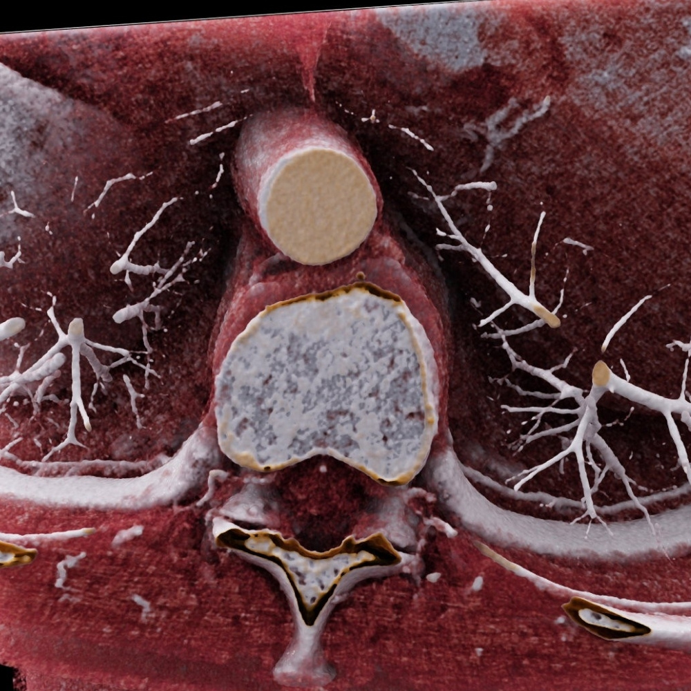imagerie cardio-vasculaire