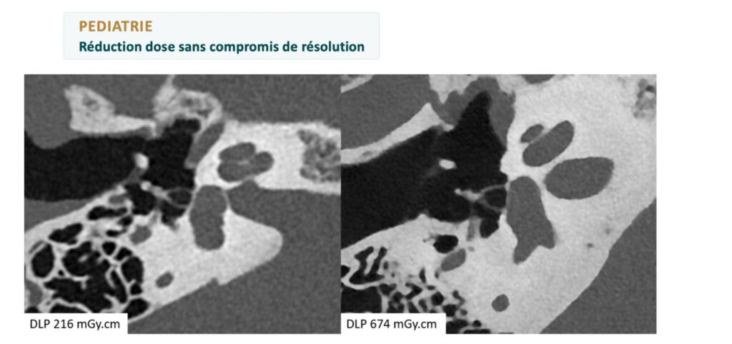 imagerie pediatrie
