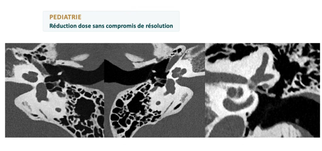 imagerie pediatrie