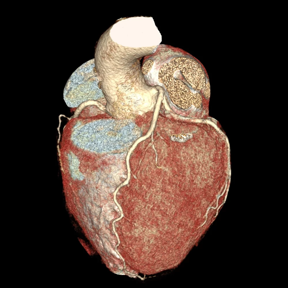 imagerie du coeur